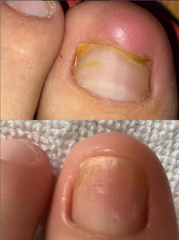 Before and After Result 2
